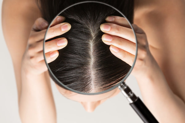 Tips for Improving Hair Growth and Scalp Health