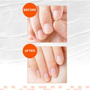 Close-up of fingers with nails showing before and after hydration