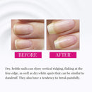 Nail Tek Foundation 3 Ridge Filler For Hard, Brittle Nails (15ml/0.5oz)