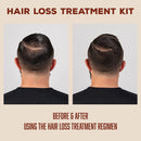 Suavecito Hair Loss Treatment Kit - 1 Month Supply