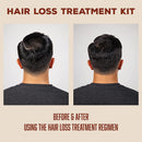 Suavecito Hair Loss Treatment Kit - 1 Month Supply