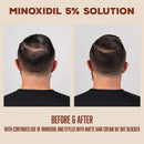 Suavecito 5% Minoxidil Topical Hair Solution (60ml/2oz)