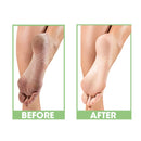 ProLinc Dry Heel Eliminator